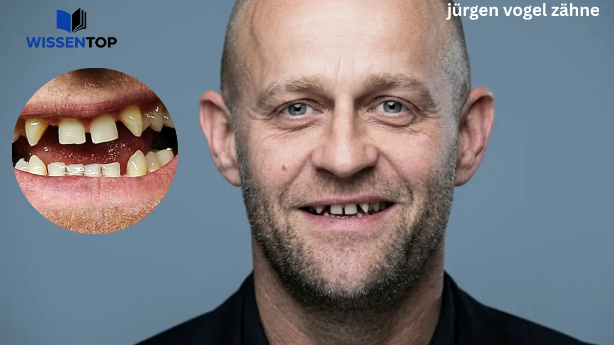 Luke Littler Freundin Jürgen vogel zähne